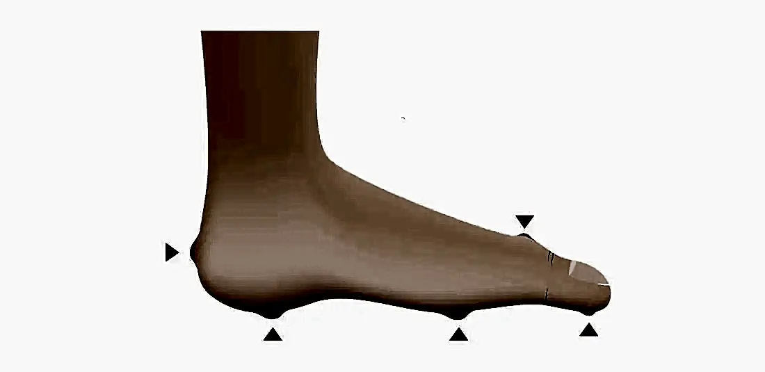 Ayak Nasırına Ne İyi Gelir